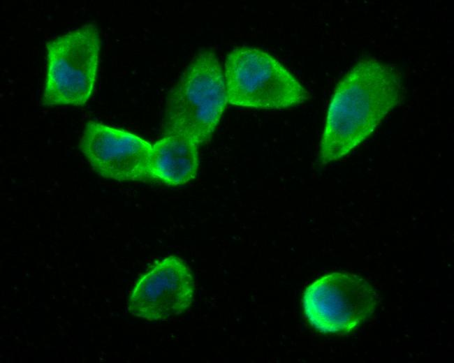 beta Galactosidase Antibody in Immunocytochemistry (ICC/IF)