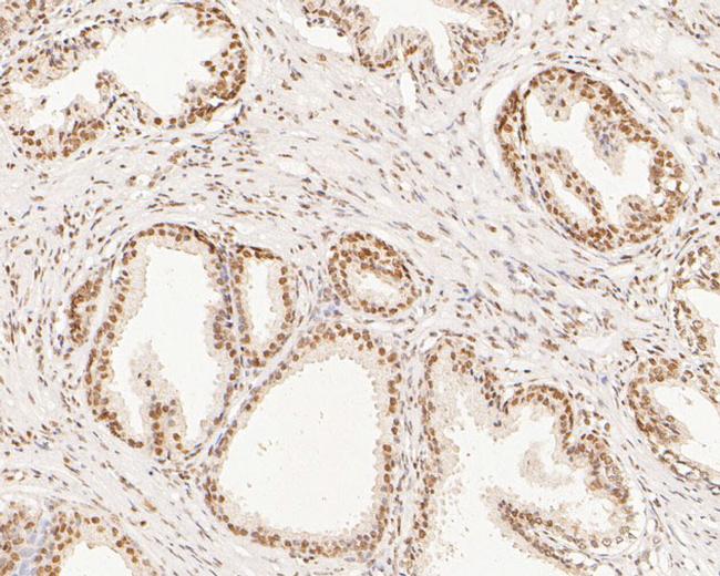 XPA Antibody in Immunohistochemistry (Paraffin) (IHC (P))