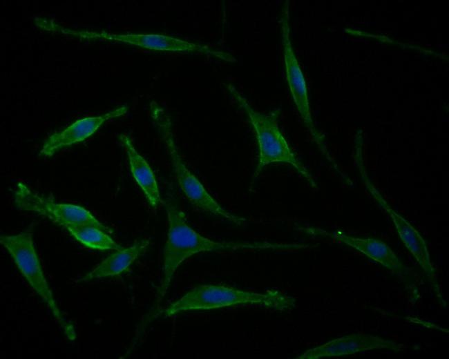 MAP2 Antibody in Immunocytochemistry (ICC/IF)