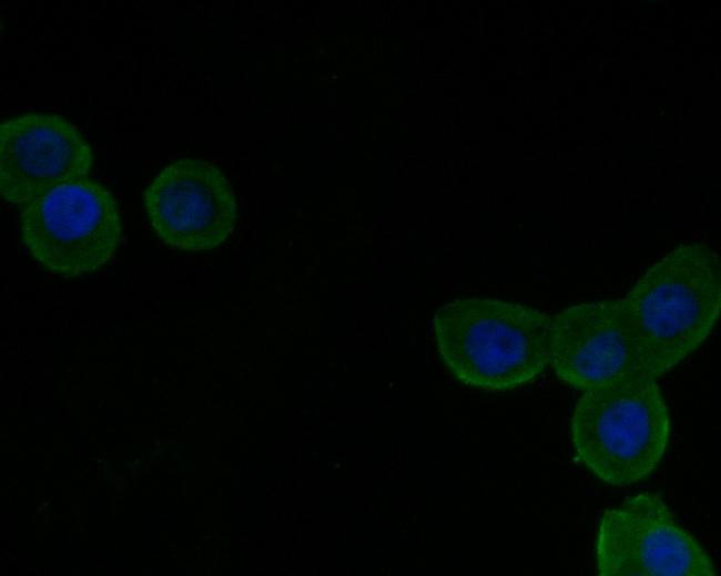 VLDLR Antibody in Immunocytochemistry (ICC/IF)