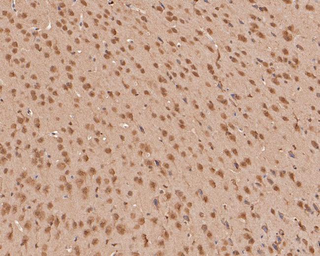 ZIC2 Antibody in Immunohistochemistry (Paraffin) (IHC (P))