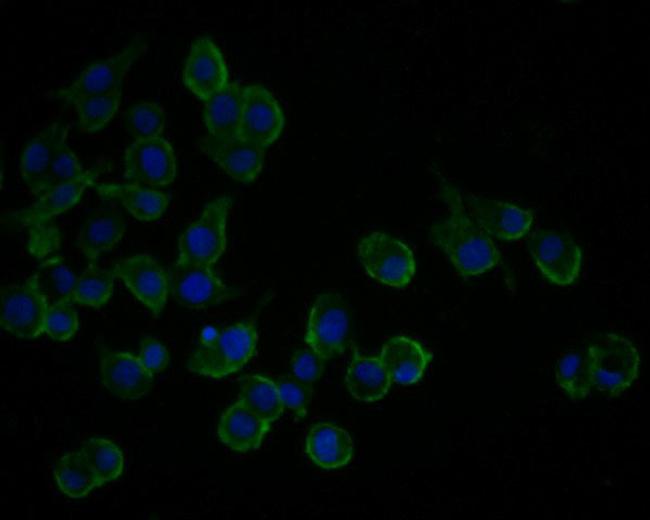 TSC1 Antibody in Immunocytochemistry (ICC/IF)