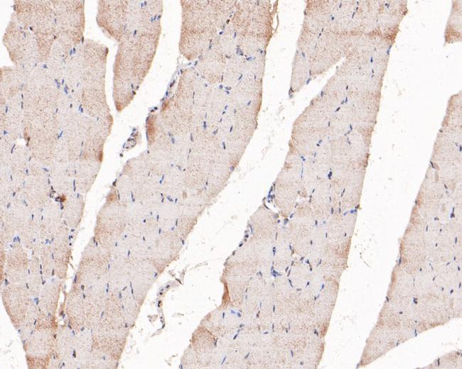 PIP5K1A Antibody in Immunohistochemistry (Paraffin) (IHC (P))