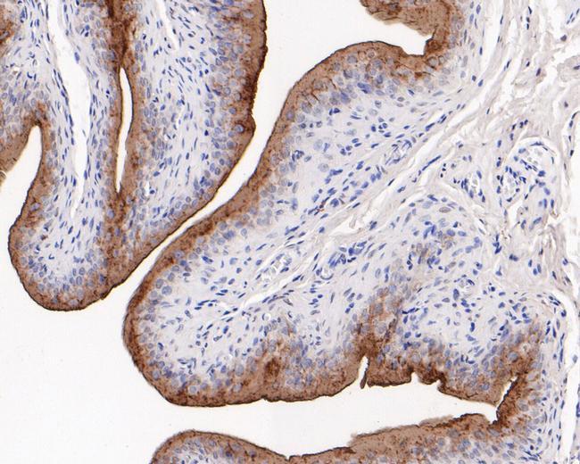 Uroplakin III Antibody in Immunohistochemistry (Paraffin) (IHC (P))