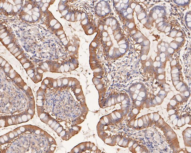 Kir7.1 (KCNJ13) Antibody in Immunohistochemistry (Paraffin) (IHC (P))