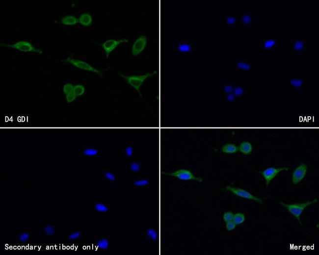 D4-GDI Antibody in Immunocytochemistry (ICC/IF)