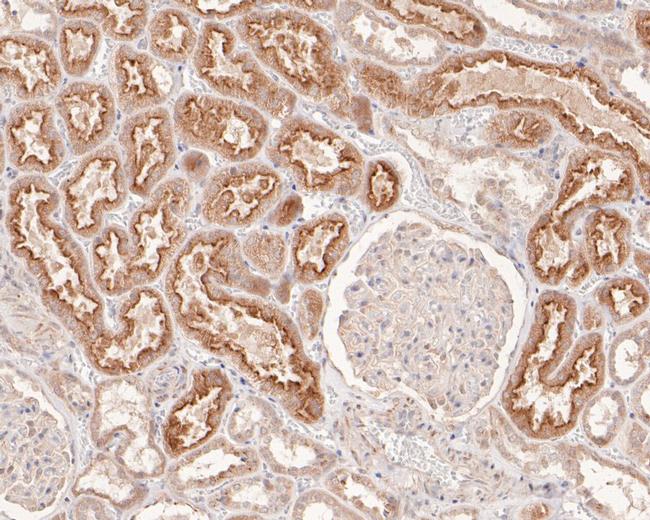 SKI Antibody in Immunohistochemistry (Paraffin) (IHC (P))