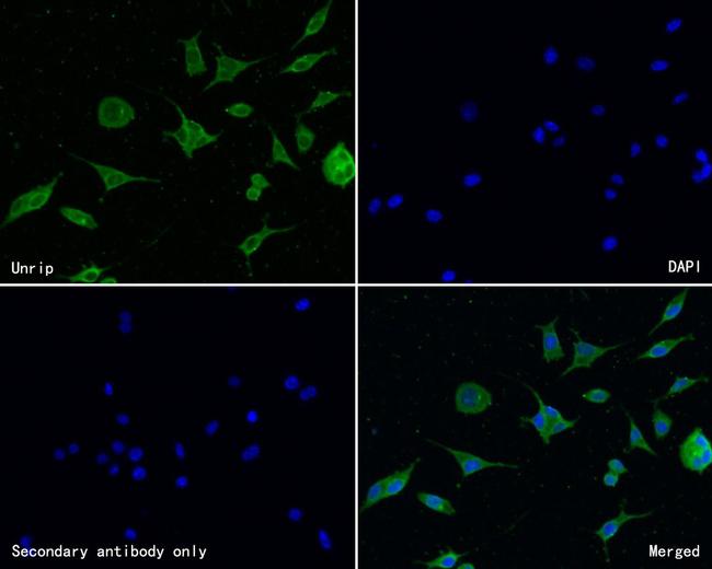 STRAP Antibody in Immunocytochemistry (ICC/IF)