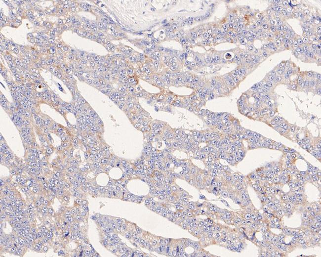 UCRC Antibody in Immunohistochemistry (Paraffin) (IHC (P))