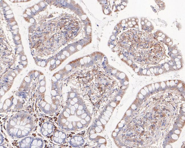 CER1 Antibody in Immunohistochemistry (Paraffin) (IHC (P))