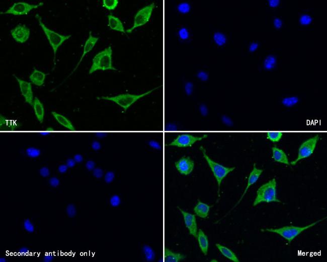 TTK Antibody in Immunocytochemistry (ICC/IF)