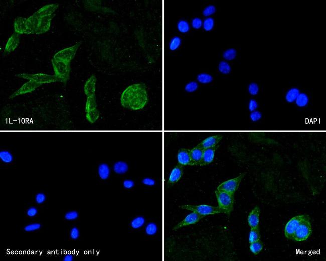 IL10RA Antibody in Immunocytochemistry (ICC/IF)