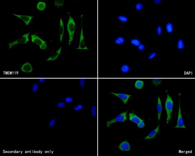 TMEM119 Antibody in Immunocytochemistry (ICC/IF)