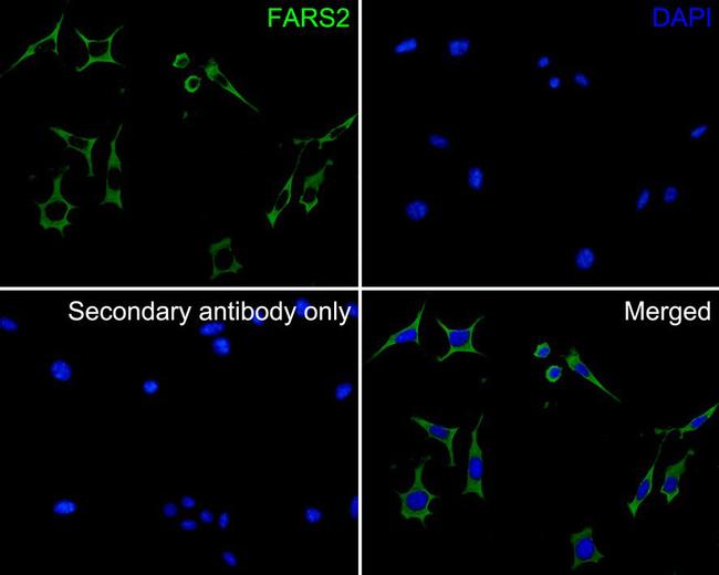 FARS2 Antibody in Immunocytochemistry (ICC/IF)