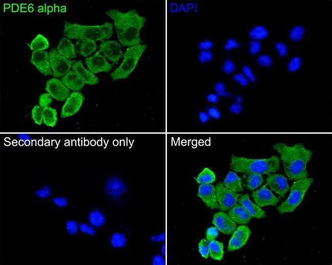 PDE6A Antibody in Immunocytochemistry (ICC/IF)