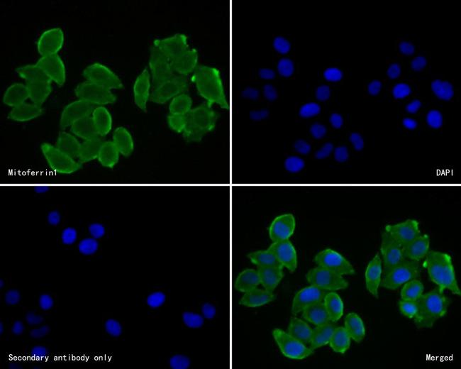 SLC25A37 Antibody in Immunocytochemistry (ICC/IF)