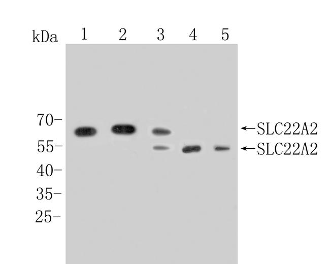 SLC22A2 Antibody in Western Blot (WB)