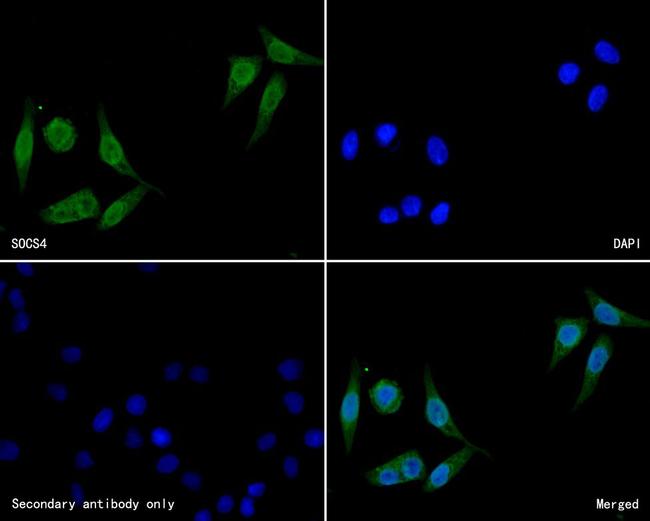 SOCS4 Antibody in Immunocytochemistry (ICC/IF)