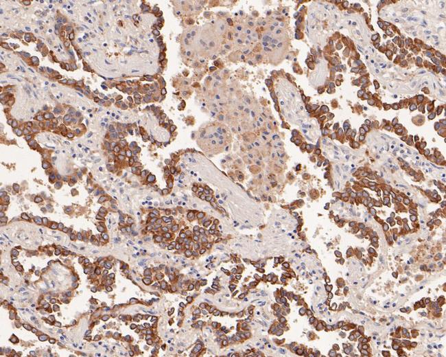 AMHR2 Antibody in Immunohistochemistry (Paraffin) (IHC (P))