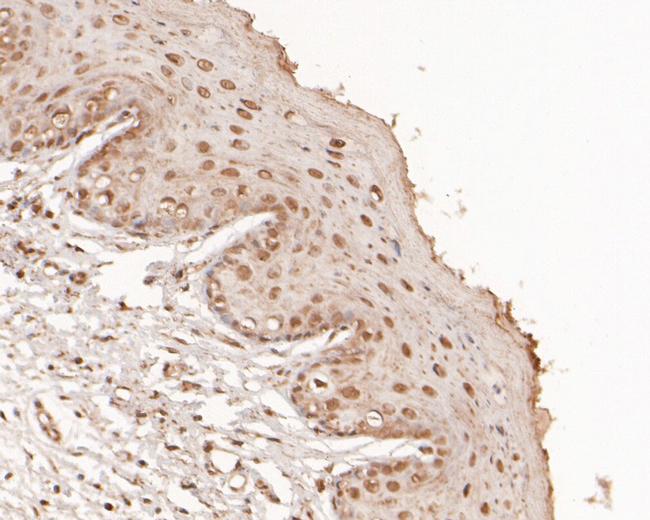 ATP1B4 Antibody in Immunohistochemistry (Paraffin) (IHC (P))