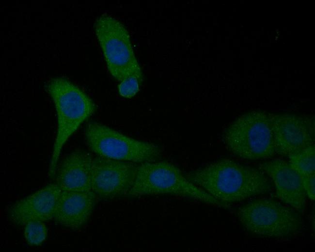 Cardiac Troponin C Antibody in Immunocytochemistry (ICC/IF)