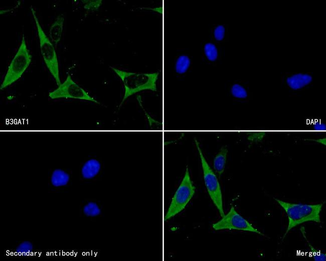 B3GAT1 Antibody in Immunocytochemistry (ICC/IF)