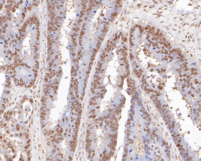 ONECUT3 Antibody in Immunohistochemistry (Paraffin) (IHC (P))