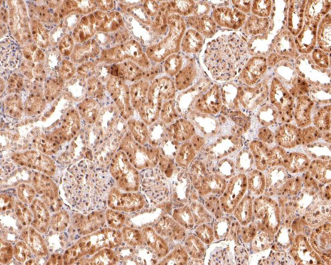 Myogenin Antibody in Immunohistochemistry (Paraffin) (IHC (P))