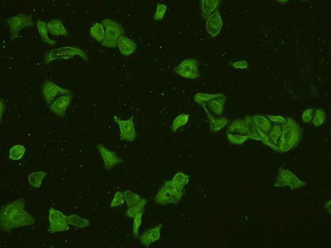 PI3K p85 alpha Antibody in Immunocytochemistry (ICC/IF)