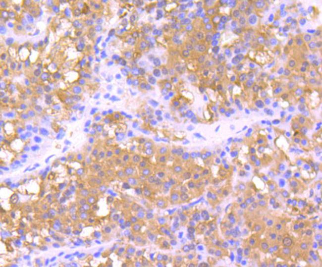 Ferritin Antibody in Immunohistochemistry (Paraffin) (IHC (P))