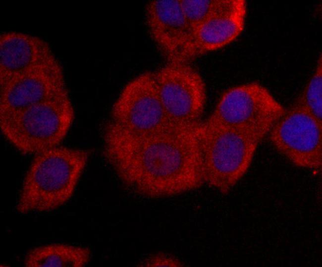 NME1 Antibody in Immunocytochemistry (ICC/IF)