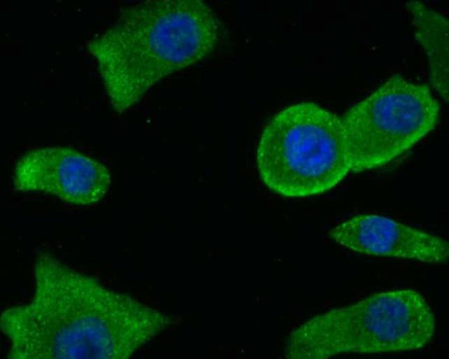 PKM2 Antibody in Immunocytochemistry (ICC/IF)