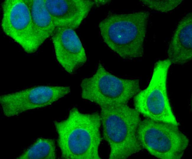 FASN Antibody in Immunocytochemistry (ICC/IF)