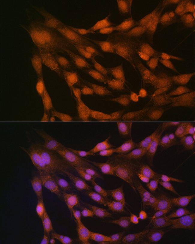 Thioredoxin 1 Antibody in Immunocytochemistry (ICC/IF)