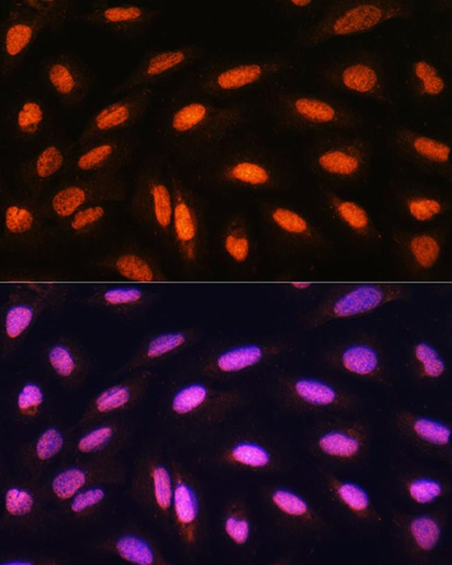 PCAF Antibody in Immunocytochemistry (ICC/IF)