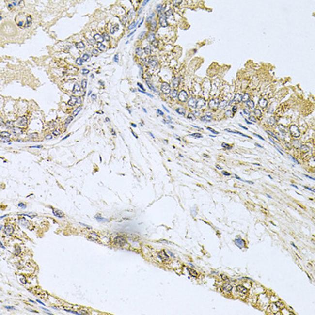 Bcr Antibody in Immunohistochemistry (Paraffin) (IHC (P))