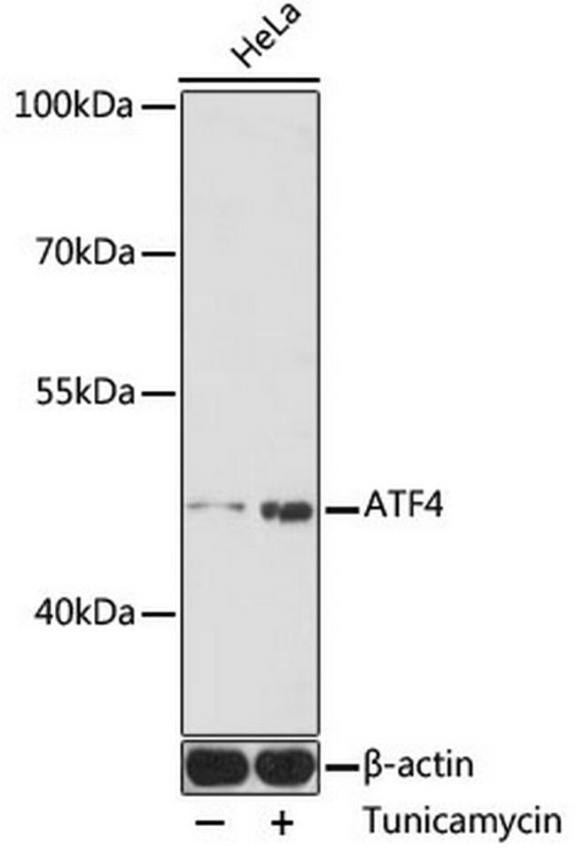 ATF4 Antibody in Western Blot (WB)