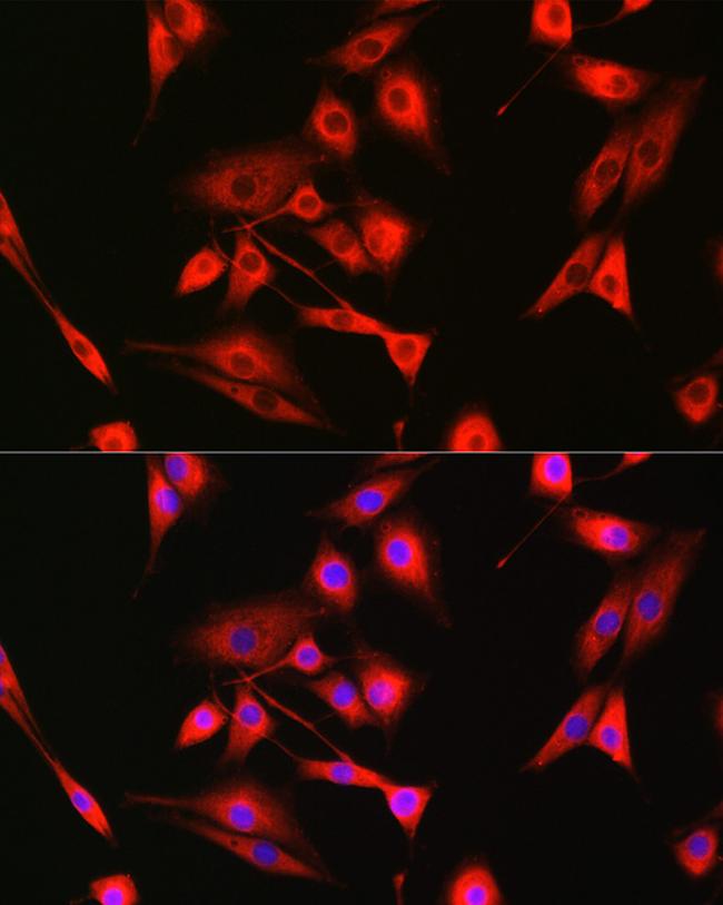 BAK Antibody in Immunocytochemistry (ICC/IF)