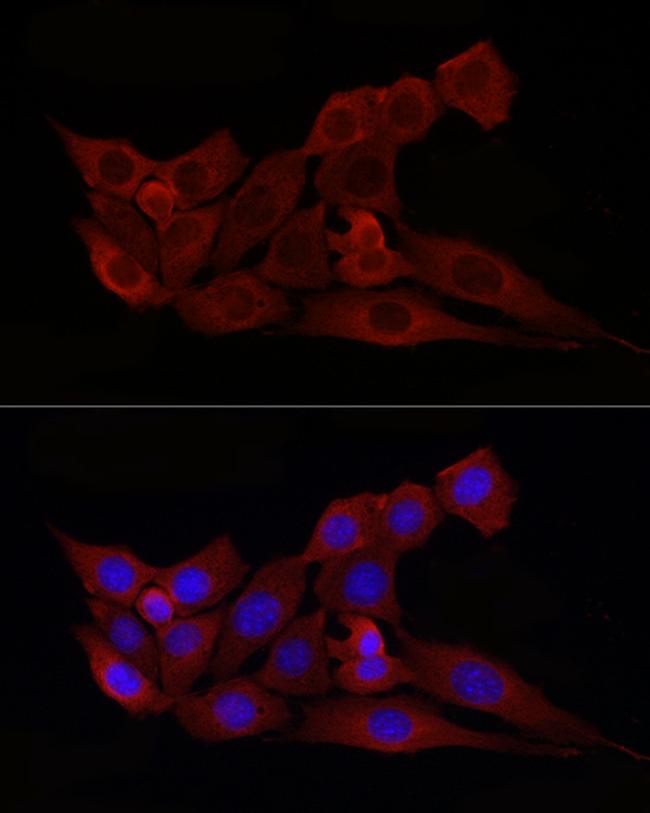 BAX Antibody in Immunocytochemistry (ICC/IF)