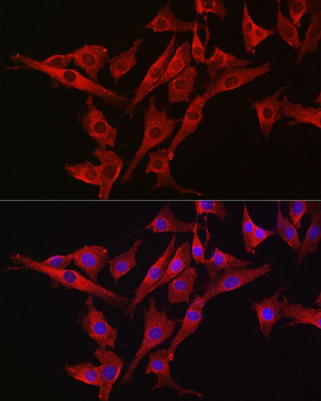 Caspase 3 Antibody in Immunocytochemistry (ICC/IF)