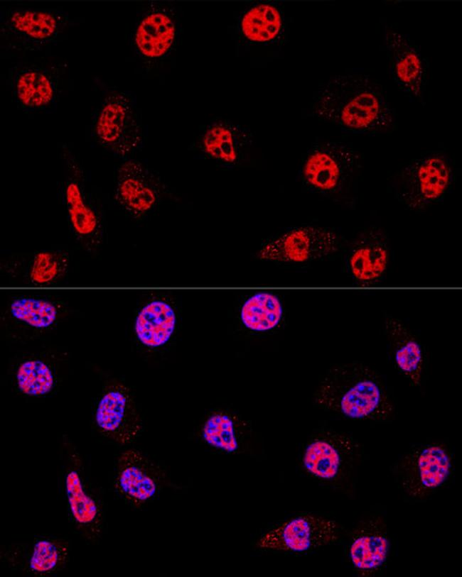 HDAC1 Antibody in Immunocytochemistry (ICC/IF)