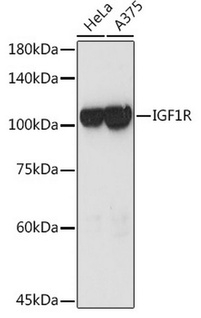 IGF1R (CD221) Antibody in Western Blot (WB)