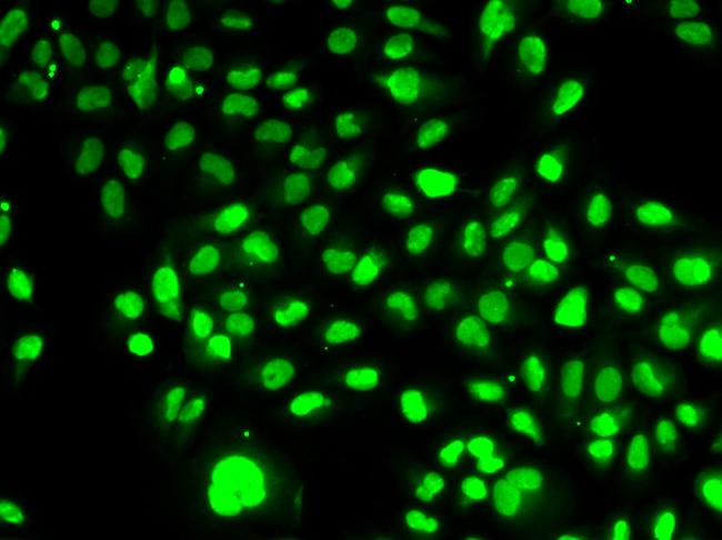 NAMPT Antibody in Immunocytochemistry (ICC/IF)