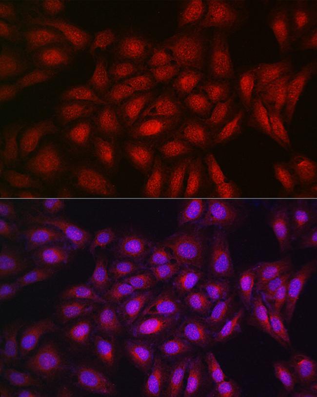 PPAR gamma Antibody in Immunocytochemistry (ICC/IF)