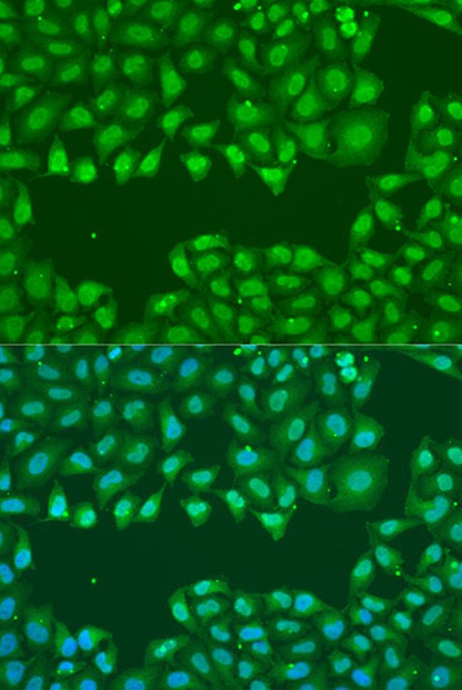 SSB Antibody in Immunocytochemistry (ICC/IF)