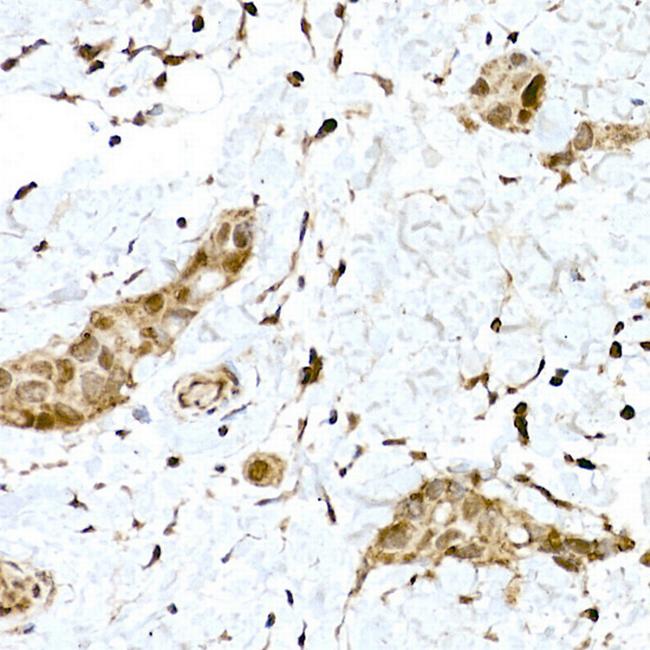 Nrf2 Antibody in Immunohistochemistry (Paraffin) (IHC (P))