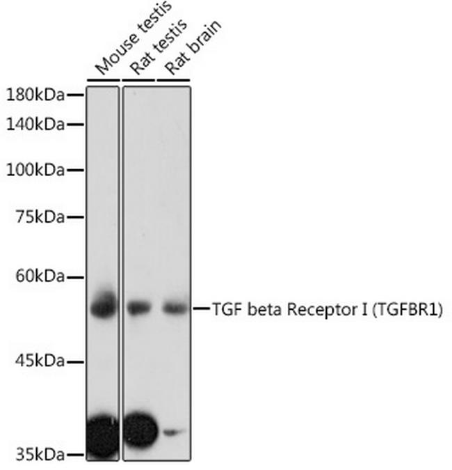 TGFBR1 Antibody in Western Blot (WB)