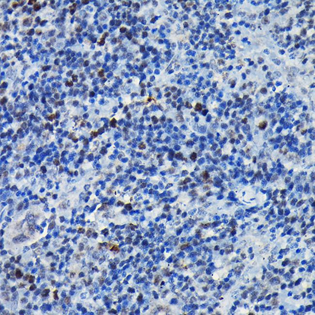 C/EBP beta Antibody in Immunohistochemistry (Paraffin) (IHC (P))