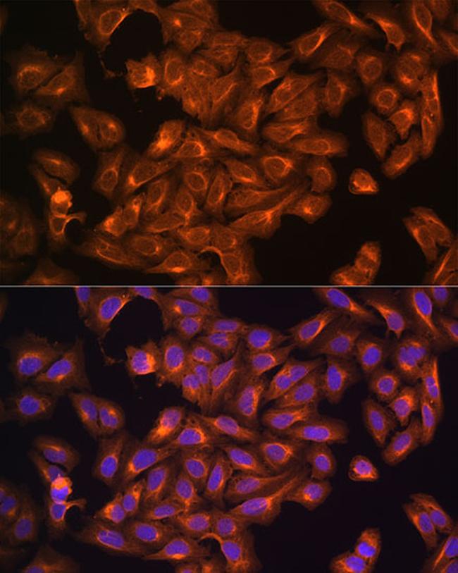 NF2 Antibody in Immunocytochemistry (ICC/IF)