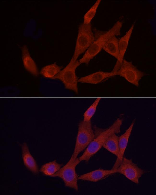 APAF1 Antibody in Immunocytochemistry (ICC/IF)